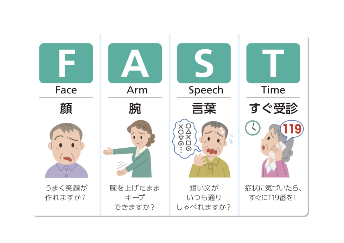 最近20~30代の脳梗塞患者が多いって知ってますか?これらの異常があったら様子を見ずに一刻も早く救急車を呼んで!!