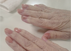 孫がおばあちゃんにネイルをしてあげたというこちらのほのぼのとした投稿。→実はこの裏には悲しい現実があって・・・