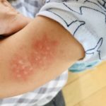 全国のパパママに届け!1歳ぐらいの子どもに多い原因不明の病気。こんな症状があったら迷わず病院へ行って欲しい!