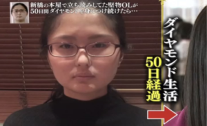 「50日間で女性の顔は変わるのか！？」という企画に参加した2人の女性。→変貌ぶりに開いた口が塞がらない・・・