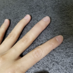 なんの変哲もない手に見えますが一つ驚きの真実があるのですが何処か分かりますか?