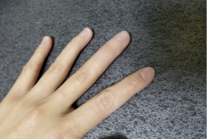 なんの変哲もない手に見えますが一つ驚きの真実があるのですが何処か分かりますか？