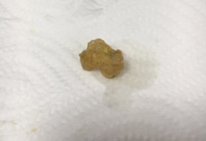 彼氏がほかの女とペアアクセサリーを持っていたことにぶちぎれた彼女がとったまさかすぎる行動に震え上がる！