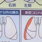 今一度確認しておきたい。『肺炎』と『新型コロナ』の違いがわかりやすいと話題に。「こう見ると改めてヤバさが分かる」