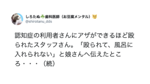 利用者さんにアザができるほど殴られたスタッフさん。その家族へ報告すると・・・対応に絶句。「このままでは国が滅びる。」