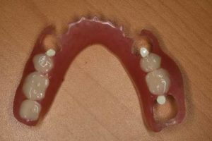 テーブルの前に置いたおばあちゃんの入れ歯。突如姿を消したため家族全員で探したら１時間後、想像もしないところからでてきた話