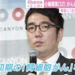 おぎやはぎの小木さんのがん告白のコメントに注目が集まっています!→今後見習う人が増えて欲しい!