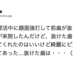 『アクシデントにより抜けた歯は洗わないで!』歯科医師からの注意喚起が目からウロコ!