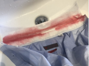 「え、血？！」夫のワイシャツに漂白剤をかけたらこんなことに・・・→多くの人が使っているであろう『アレ』に注意！