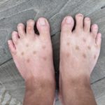 先週あたりから足の表にできた謎の斑点、何という病気か調べても一切出てこず悩んでいたら・・・驚くべき理由が判明！