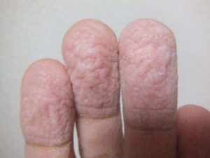 知らなかった・・！ 『水で手がシワシワになる理由』に衝撃の嵐！
