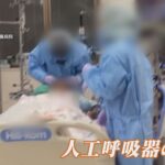 人工呼吸器をつけた人がどんな経過になるか知っていますか?覚えておくべき現実・・・
