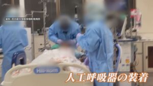 人工呼吸器をつけた人がどんな経過になるか知っていますか？覚えておくべき現実・・・