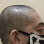「髪の毛が入っている」と苦情を受けたたこ焼き屋さん。→頭を丸刈りにし謝罪に行った結果・・・