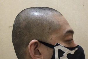 「髪の毛が入っている」と苦情を受けたたこ焼き屋さん。→頭を丸刈りにし謝罪に行った結果・・・