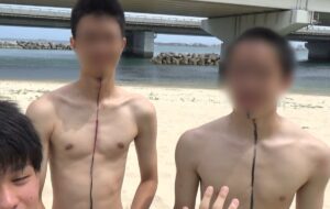 日焼け止めって本当に効果あるの？→検証した結果がこちら・・・