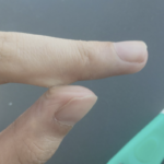 セメダイン公式が教える!瞬間接着剤で皮膚同士がくっついてしまった時は・・・「痛い思いしなくてもとれるのか!」