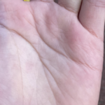 「なんか薬指の血管死んでる」写真を見てみたら・・えぇっ!?何これ。