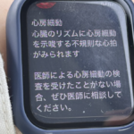 Apple Watchに『心房細動が見られる』との通知が!仕事を抜け、病院へ行ったら・・・